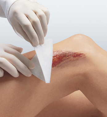 Leukoplast Compress non woven Steril - www.gulare.com